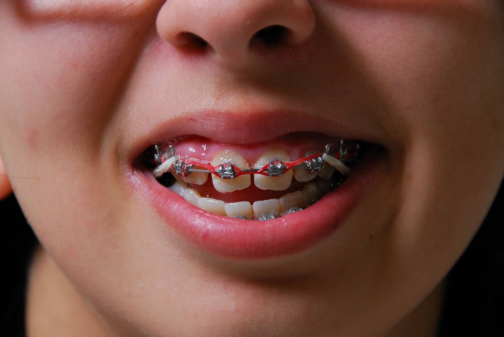 Runcorn Dental, Dental Care in Runcorn, Queensland